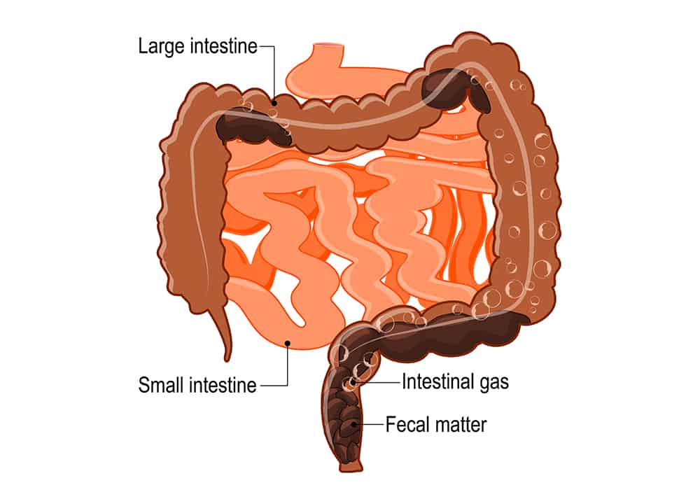 Gases intestinales y aumento de peso